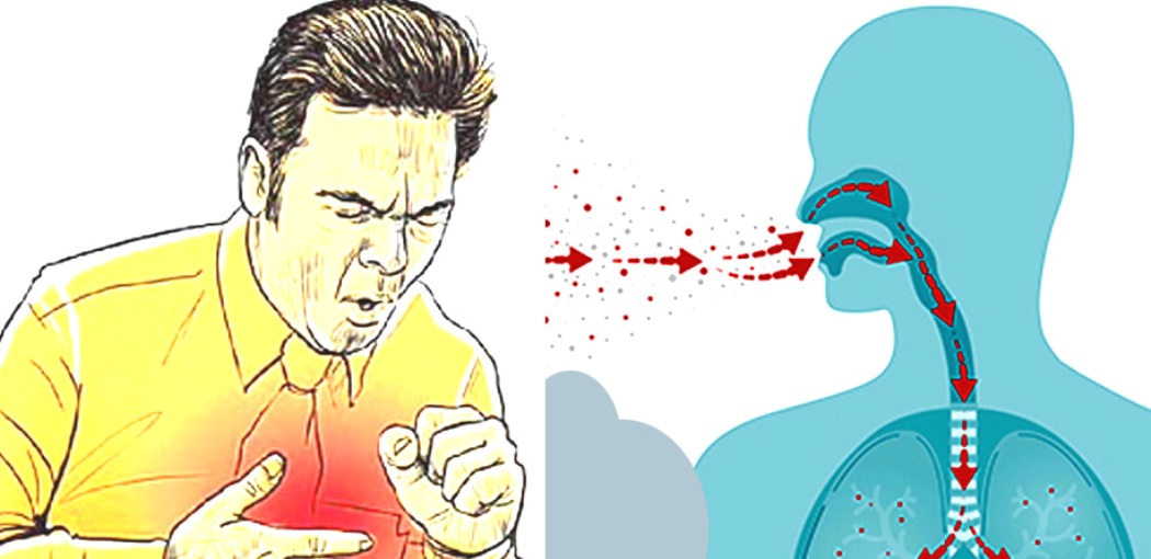 आज विश्व क्षयरोगविरुद्धको दिवस,जनचेतनामूलक कार्यक्रम गरी मनाइँदै