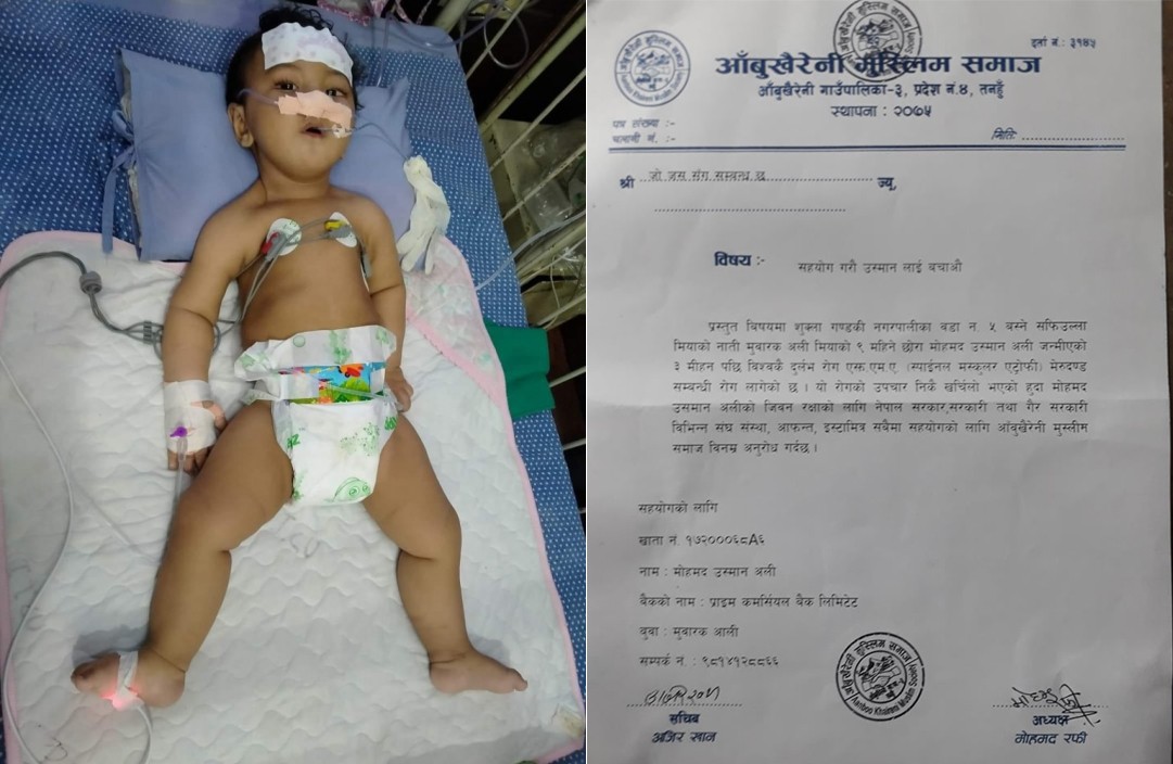 नेपालका ९ महिने बालकलाई लाग्यो विश्वकै दुर्लभ रोग, यसरी जुटाइदैछ उपचार खर्च