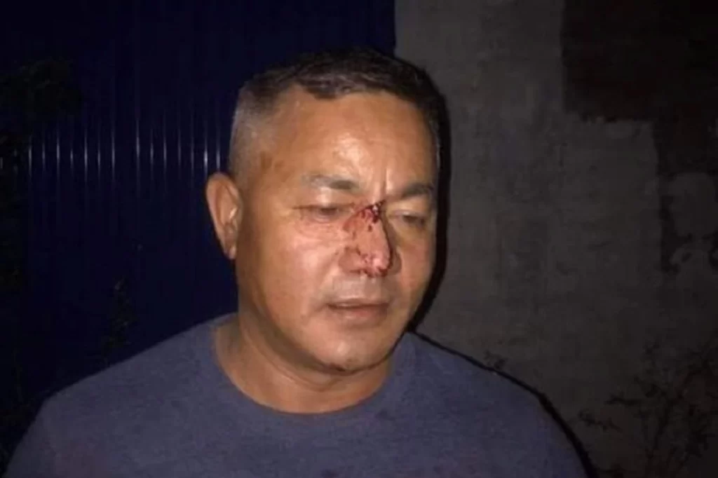 गाउँपालिका अध्यक्षमाथि आक्रमण