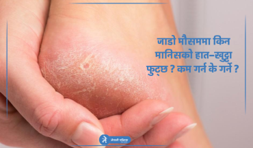 जाडो मौसममा किन मानिसको हात–खुट्टा फुट्छ ? कम गर्न के गर्ने ? 