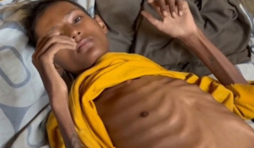 उपचार नपाएर ओछ्यानमै थलिएका १९ वर्षीय विजय यादव