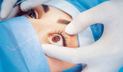 सिन्धुपाल्चोकमा ८४ जनाले फिर्ता पाए आँखाको ज्योति