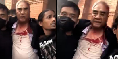 जेन-जीको आक्रमणमा घाइते देउवाको गर्दनमाथि १२ टाँका, अहिले कस्तो छ स्वास्थ्य अवस्था ?