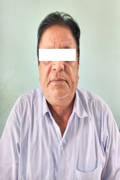 एक करोड २५ लाखको बैंकिङ कसुर मुद्दा लागेका थापा पक्राउ