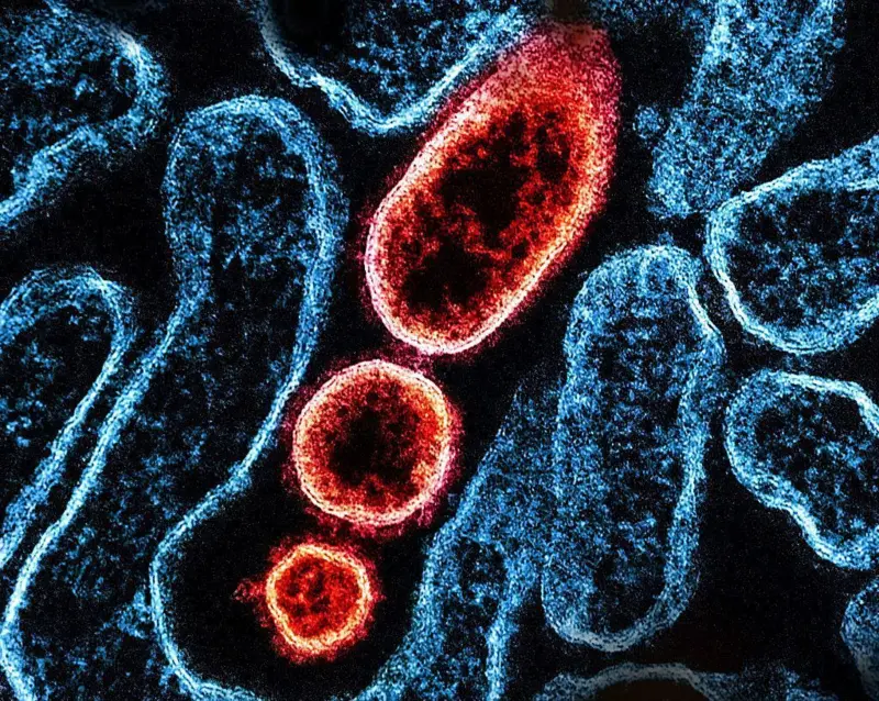 निपा भाइरसको जोखिम, भारतबाट आउनेमाथि बढाइयो निगरानी