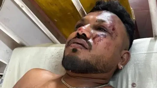 अहमदाबाद विमान दुर्घटनामा एक व्यक्तिको जीवितै उद्धार