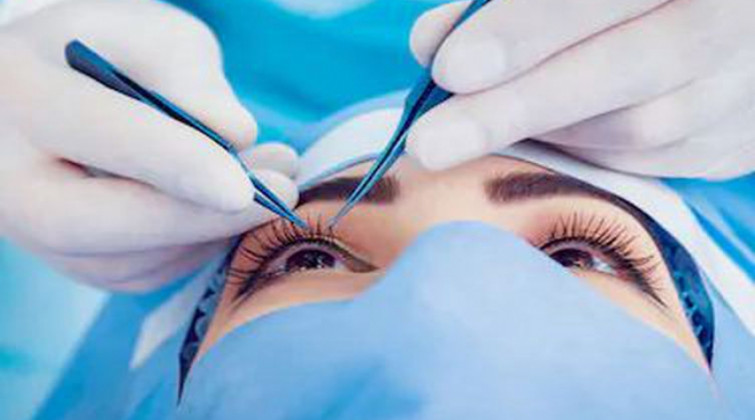 मोतियाबिन्दु भएका बिरामीको निःशुल्क शल्यक्रिया