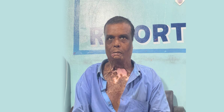 आलमले अदालतबाट सफाइ पाएपछि बम लागेका गौरीशंकरले यसरी सुनाए आफ्ना पीडा 