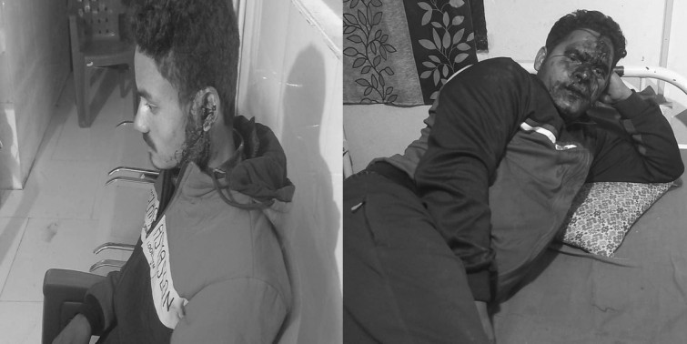 दार्चुलामा एमाले र गठबन्धनका कार्यकर्ताबीच झडप