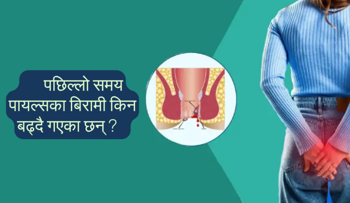 पछिल्लो समय पायल्सका बिरामी किन बढ्दै गएका छन् ?