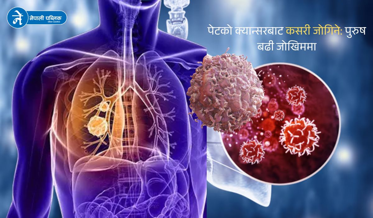 पेटको क्यान्सरबाट कसरी जोगिने ?  पुरुष बढी जोखिममा