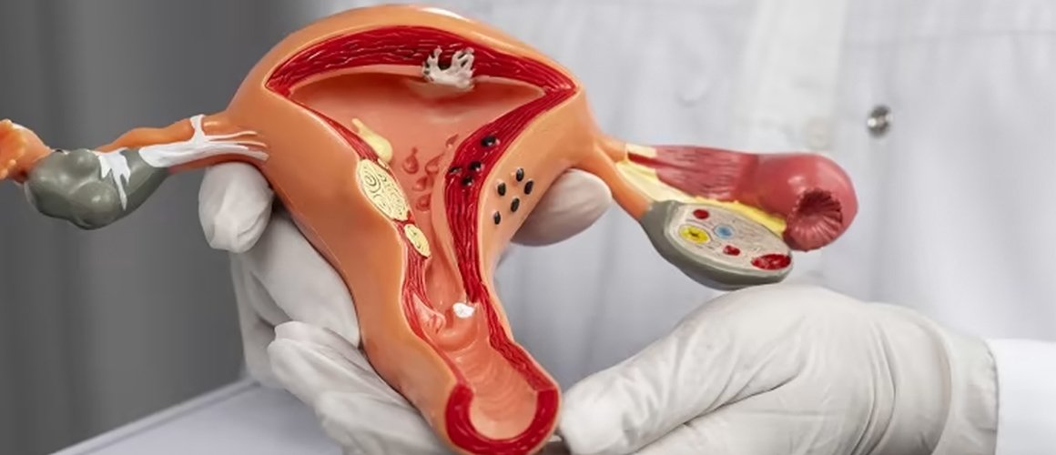 नेपालमा पहिलो पटक ‘पाठेघर मुखको क्यान्सर निवारण दिवस’ मनाइयो  