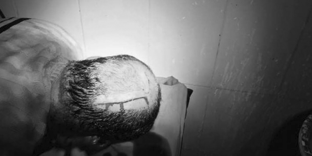 कांग्रेस अधिवेशन : मतगणना भईरहेका बेला एक जनामाथि बोतल प्रहार